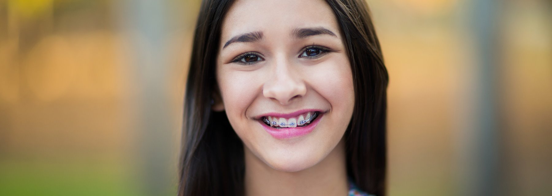 Adolescent Orthodontic Treatment in,Oregon